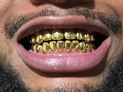 Pin by scooby on SMILE!!! | Gold teeth grills, Gold teeth, Gold grillz