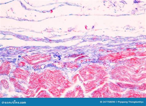 Tissue of Stomach Human Under the Microscope in Lab. Stock Photo ...