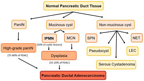 Pancreatic Pseudocyst Diagram