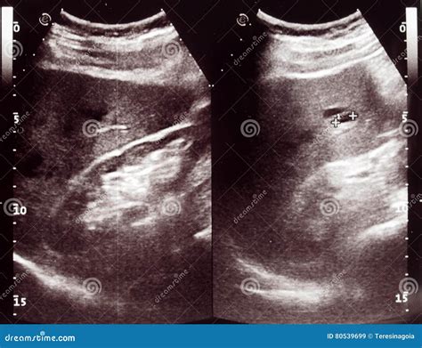 Diagnostic Sonography Of Abdomen Stock Image | CartoonDealer.com #80539699