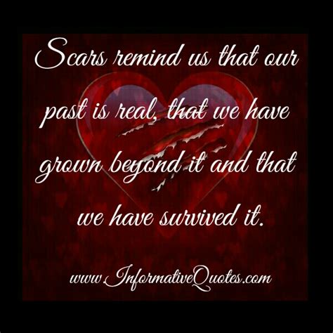 What scars remind us about? - Informative Quotes