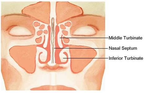 What is a Concha Bullosa – Ling Zhou, MD