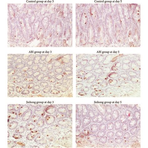 TUNEL analysis: TUNEL staining for apoptosis on the intestinal tissue... | Download Scientific ...