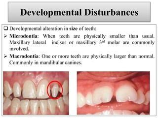 Diffrential diagnosis of common teeth complaints | PPT | Free Download