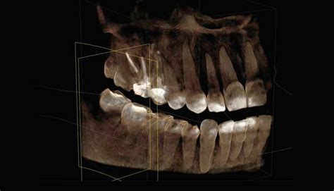 Remembering Your Roots - Dimensions of Dental Hygiene