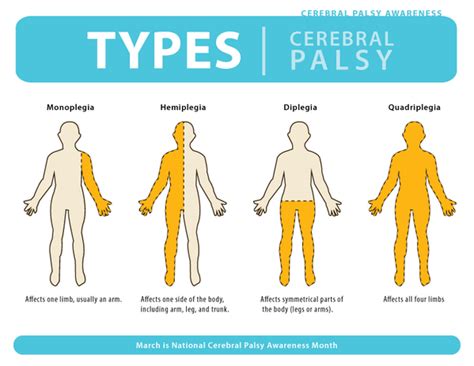 stimr.com: Hemiplegia & the OT role