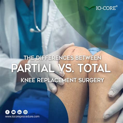 The Differences Between Partial Vs. Total Knee Replacement | iO-Core