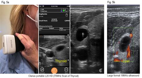 Point-of-Care Ultrasound Review of the Clarius L20 HD by Dr. Bard - Clarius Mobile Health