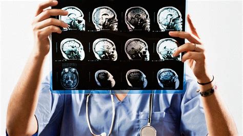 Cerebellar stroke: Symptoms, prognosis, treatment, and more