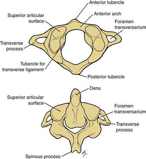 Pictures Of Atlas Axis Joint