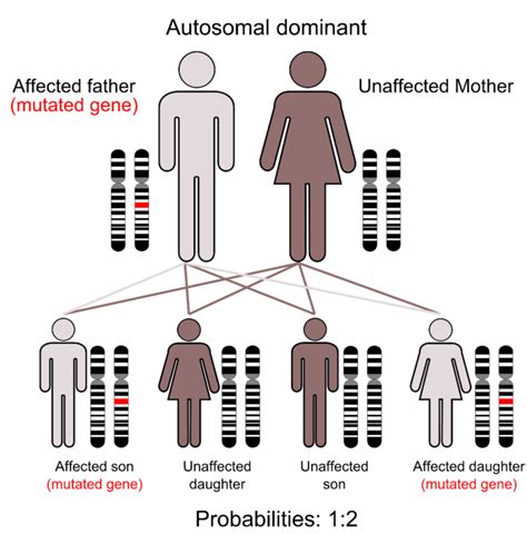 Noonan Syndrome - Physiopedia