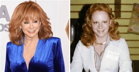 Has Reba McEntire had plastic surgery? Expert weighs in | MEAWW