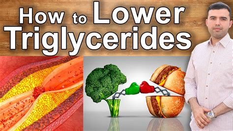 How To Reduce Triglycerides With Diet - Respectprint22