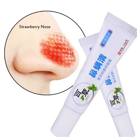 Rosacea Treatment Gel Nose Redness Removal Cleaning Antibacterial Gel ...