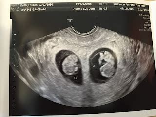 Keithing up with the Twins: Announcing Twins!