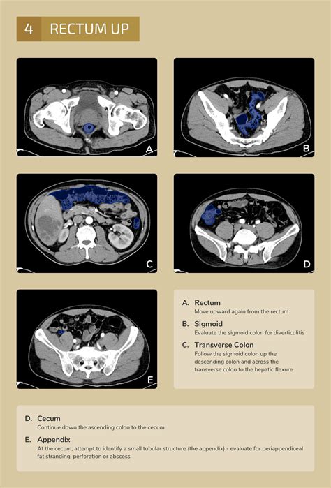 Differential Diagnosis of Infographic: CT Abdomen/Pelvis Interpretation