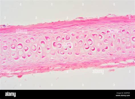 Osteocyte Microscope