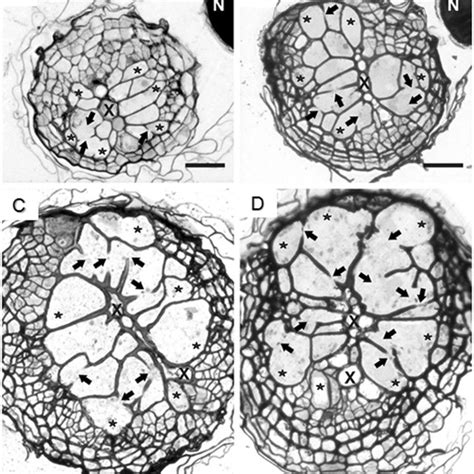 Anatomy of nematode-induced syncytia. Light microscopy images of cross ...