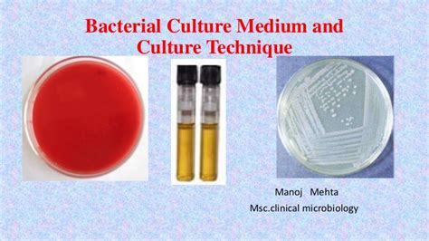 Bacterial culture media by manoj