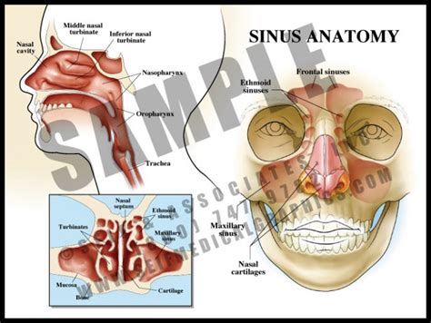 Sinus Anatomy - S&A Medical Graphics