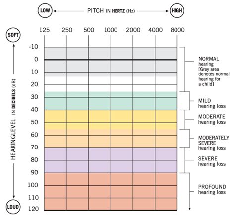 Understanding an audiogram (hearing test results)