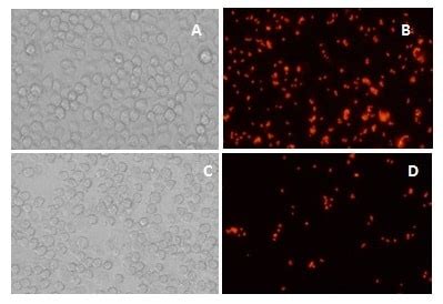 Phagocytosis Assay Kit (Red Zymosan) (ab234054) | Abcam