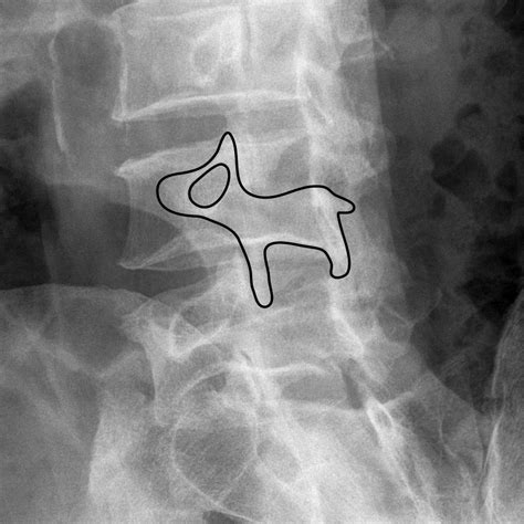 Scottie dog lumbar spine Diagram | Quizlet