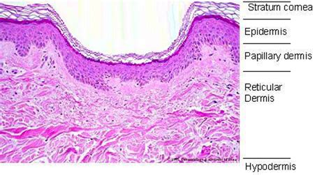 Boxcar Acne Scars Treatment - Gainesville Florida