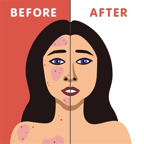 Premium Vector | Vector image of fair woman before and after acne skin ...