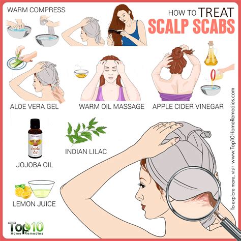 How to Treat Scalp Scabs | Top 10 Home Remedies