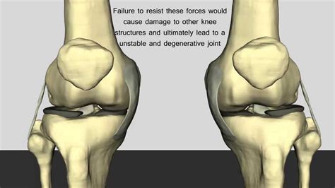 The Normal Function of the Anterior Cruciate Ligament - YouTube