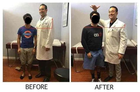 Height Increase Surgery In Pakistan – Get Taller Quick | Get taller ...