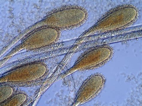 the hidden line of microscopic fungi 08 | Microbiology, Fungi, Microscopic