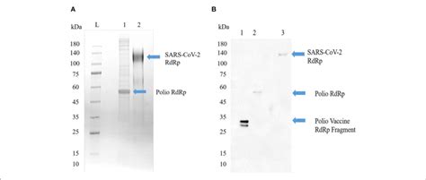 | Poliovirus RdRp contains one or more epitopes recognized by... | Download Scientific Diagram