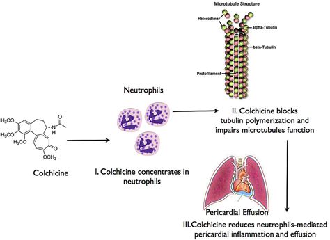 Colchicine for postoperative pericardial effusions: not the magic ...