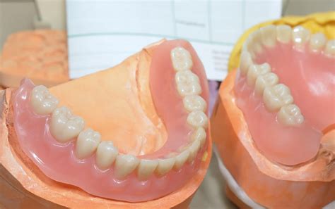 What Happens When Your Dentures Dry Out | Denture Implant