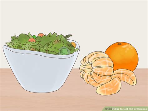 3 Ways to Get Rid of Bruises - wikiHow