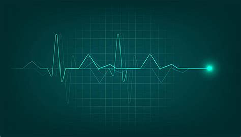 Heart Beat Line Vector Analysis Electrocardiogram Cardiology Vector, Analysis, Electrocardiogram ...