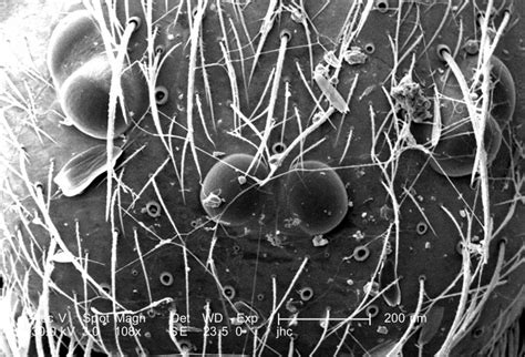 Free picture: micrograph, dorsal, cephalothorax, combination, head ...