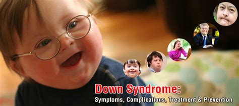 Down Syndrome Symptoms