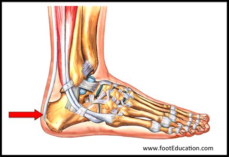 Achilles Tendon Disorders – Orthopaedia: Foot & Ankle