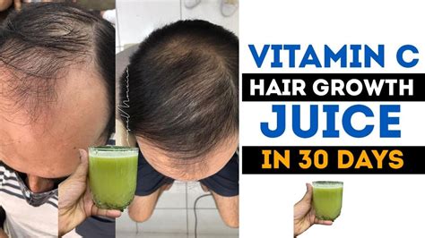 VITAMIN C HAIR GROWTH JUICE IN 30 DAYS | Hair growth, Natural skin care, Vitamin c