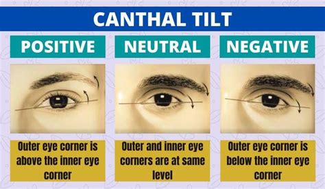 Does Your Canthal Tilt Affect Your Face Attractiveness?