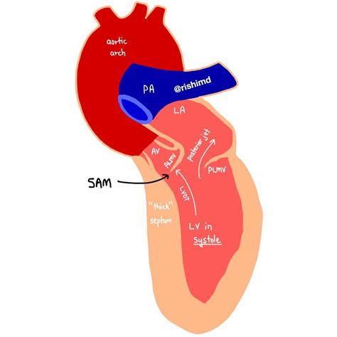 Mitral Valve