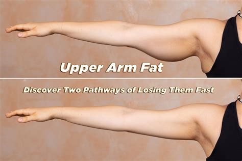 Upper Arm Fat - Discover Two Pathways of Losing Them Fast