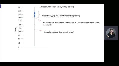 Auscultatory gap-explained - YouTube