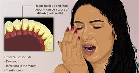 Home Remedies for Halitosis