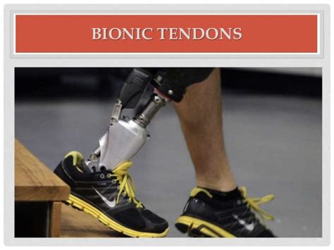 Bionic technology