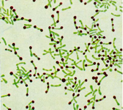 Corynebacterium diphtheriae Antigens - Creative Diagnostics