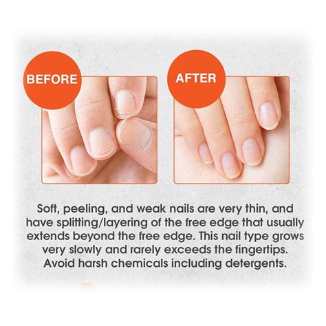 Nail Tek Intensive Therapy 2 - for Soft and Peeling Nails